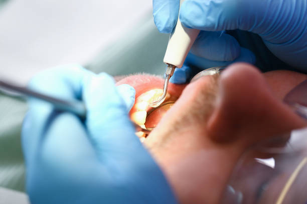 Best Emergency Treatment for Toothache in Springfield, MO