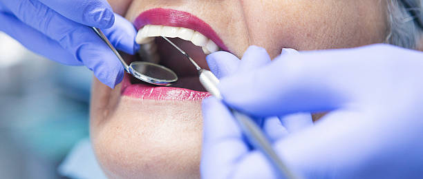 Best Walk-In Emergency Dentist in Springfield, MO